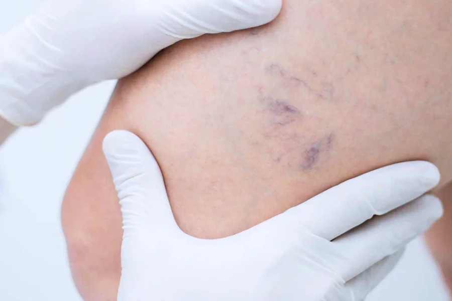 Флебология