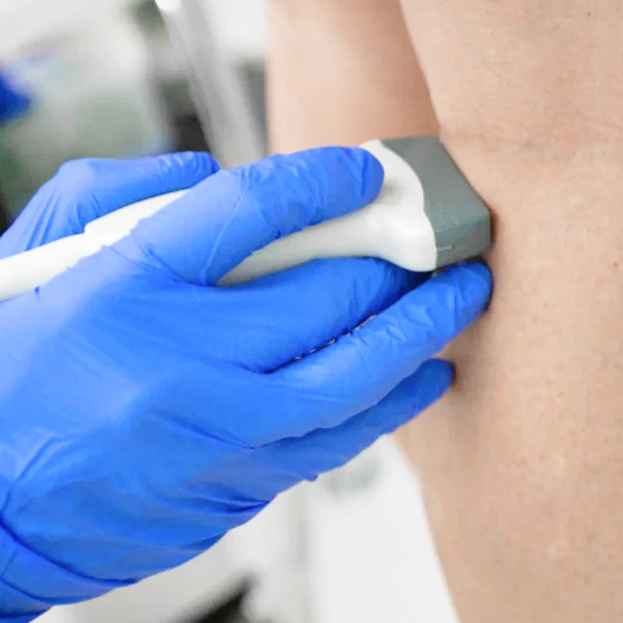 Прием флеболога + УЗИ-скрининг вен ног 1500 ₽